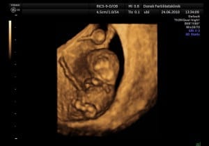 Read more about the article Tab dig gravid!